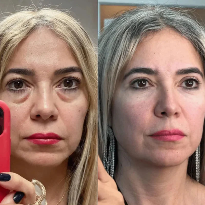 EMS Micro-Current Eye Massager